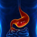 胃液の色について！赤や緑、茶色の場合は危険なの？
